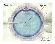 ovulo fertilización asistida con técnica de ICSI