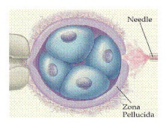 ruptura o eclosión asistida